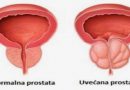 prostata