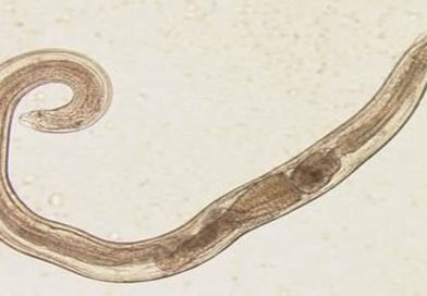 crijevni parazit pinworm