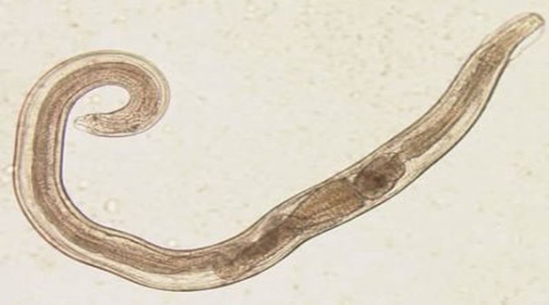 crijevni parazit pinworm